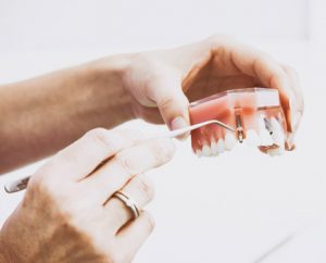 restorative dentistry- albany new york